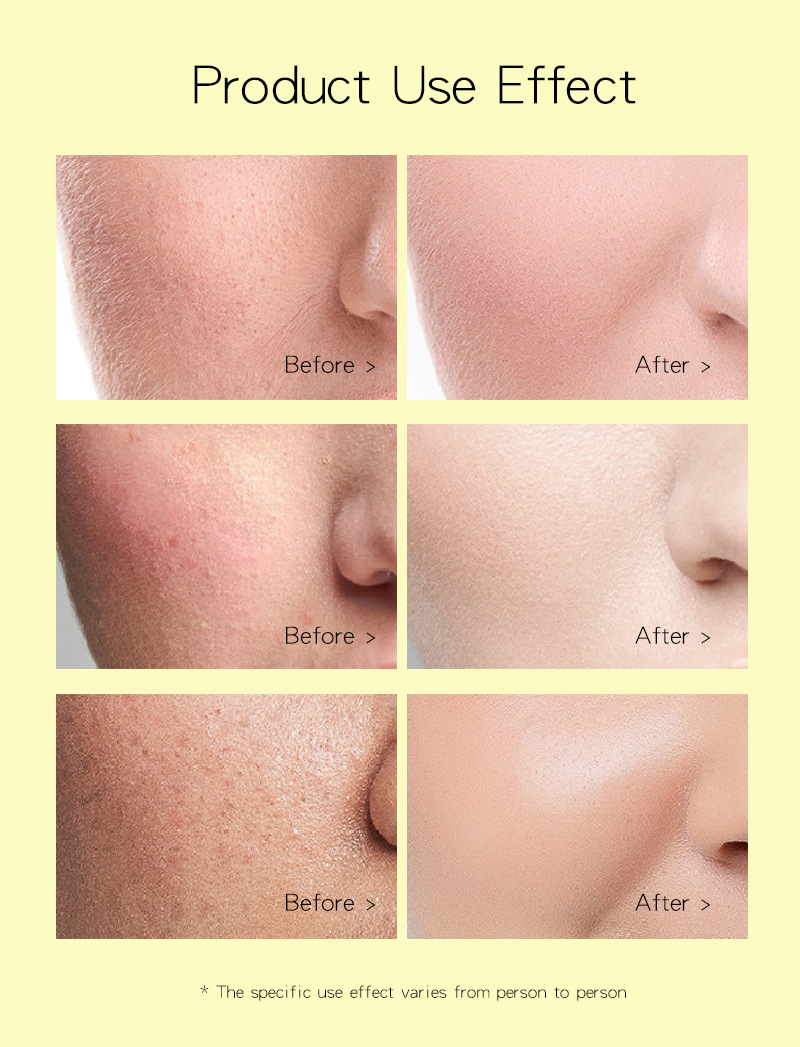 KOREAN FACE MASK Dark Spot Remover (Vegan Powder Jelly)