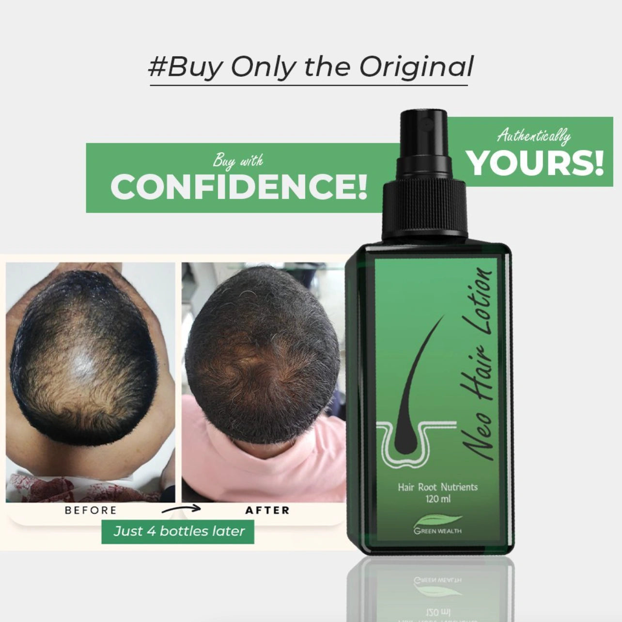 Neo HAIR LOTION FOR HAIR GROWTH (Original)