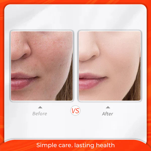 CLEANING PORES FACIAL MASK Acne Remover