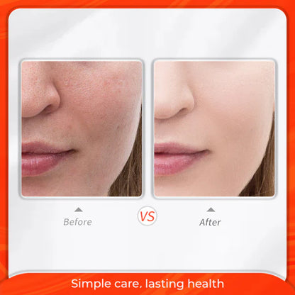 CLEANING PORES FACIAL MASK Acne Remover